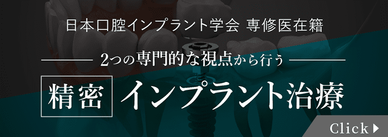 精密インプラント治療について